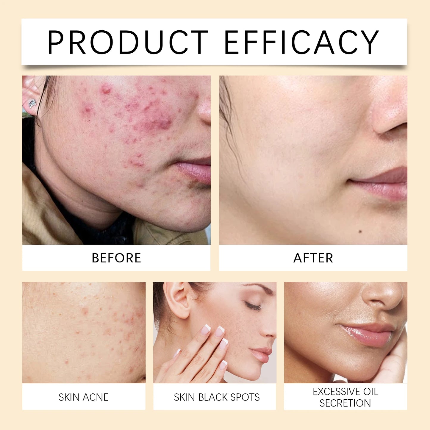 PADS ANTI-IMPERFECCIONES
